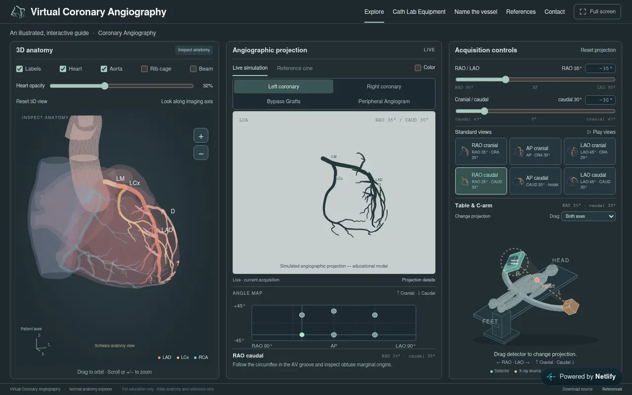 Screenshot of learncoronary.com